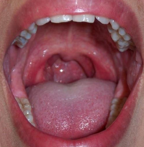 Closeup of an open mouth