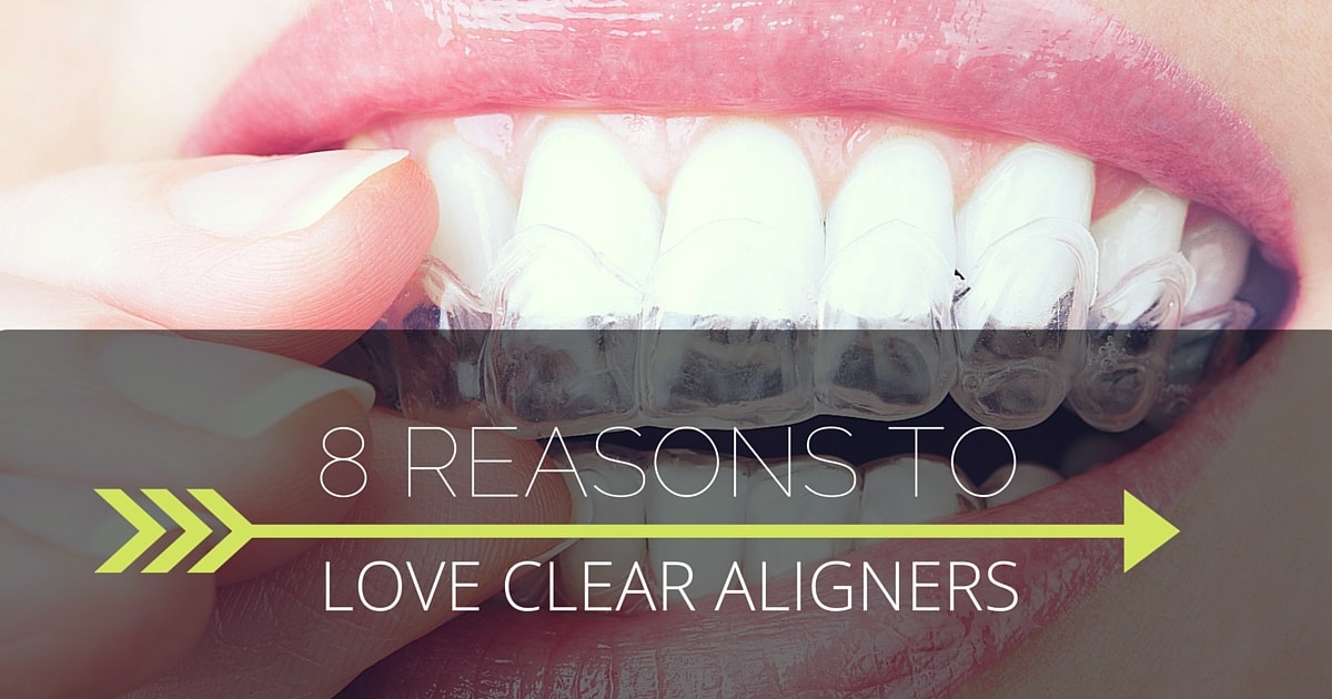 Why You'll Love Clear Aligners