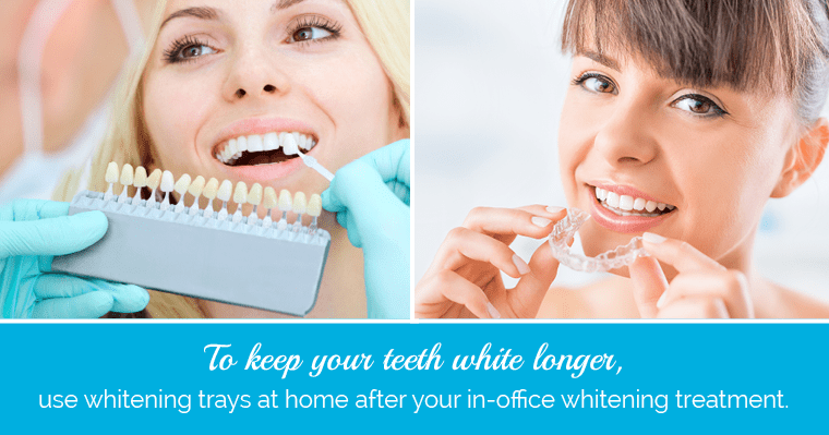 Use a combination approach to keep your teeth white longer after whitening