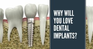 Why will you love dental implants?